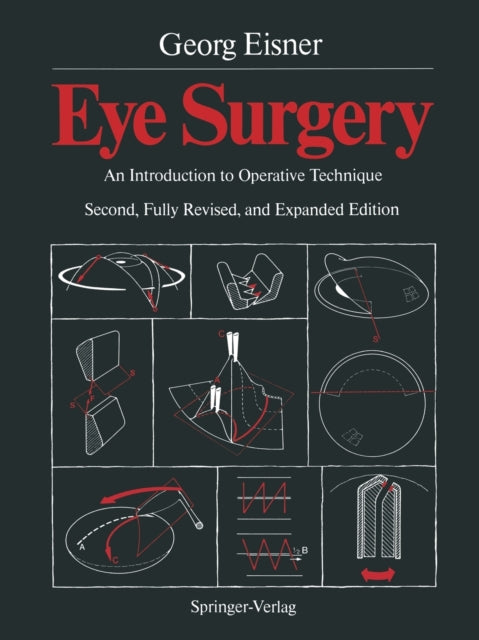 Book cover of: Eye Surgery. By: Georg Eisner
