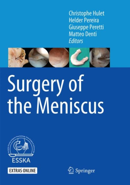 Book cover of: Surgery of the Meniscus. By: Christophe Hulet