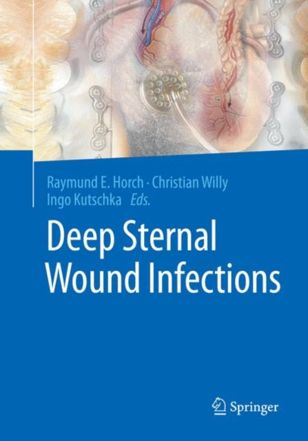 Book cover of: Deep Sternal Wound Infections. By: Raymund E. Horch