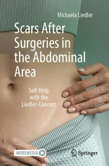 Book cover of: Scars After Surgeries in the Abdominal Area
