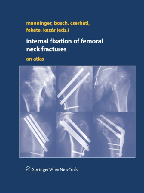 Book cover of: Internal fixation of femoral neck fractures. By: Jenó Manninger