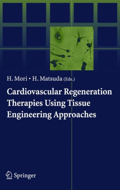 Book cover of: Cardiovascular Regeneration Therapies Using Tissue Engineering Approaches