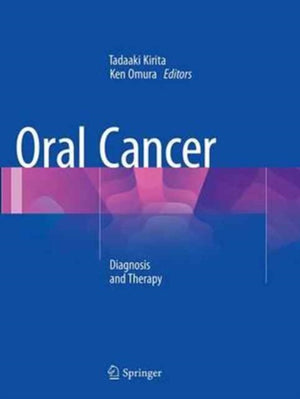 Oral Cancer