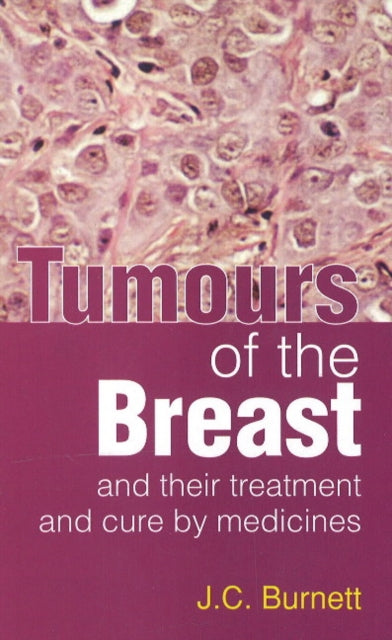 Book cover of: Tumours of the Breast. By: J. C. Burnett
