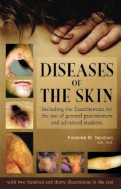 Book cover of: Diseases of the Skin. By: Frederick M. Dearborn
