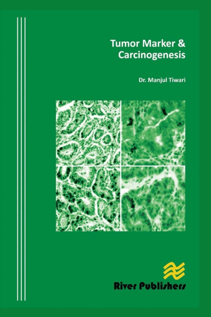 Tumor Marker and Carcinogenesis