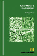 Tumor Marker and Carcinogenesis