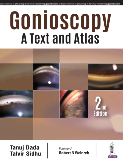Book cover of: Gonioscopy: A Text and Atlas. By: Tanuj Dada
