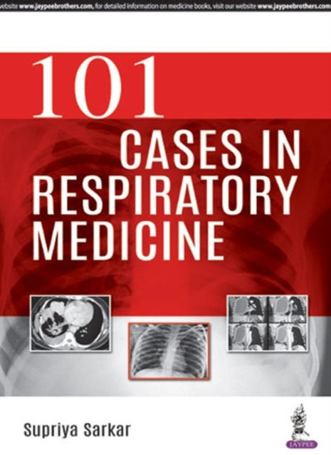 Book cover of: 101 Cases in Respiratory Medicine. By: Supriya Sarkar