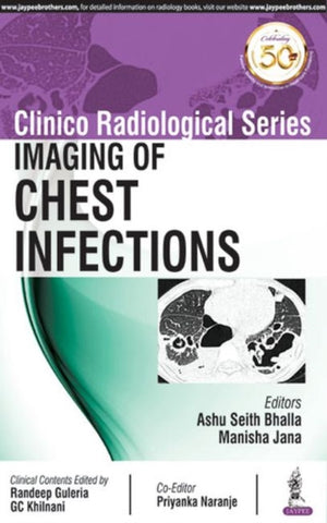 Clinico Radiological Series: Imaging of Chest Infections