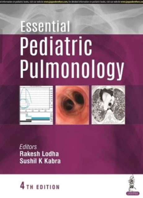 Book cover of: Essential Pediatric Pulmonology. By: Rakesh Lodha