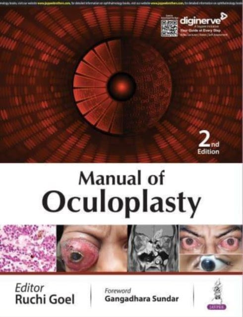 Book cover of: Manual of Oculoplasty. By: Ruchi Goel