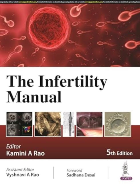 Book cover of: Infertility Manual. By: R. A. O. RAO