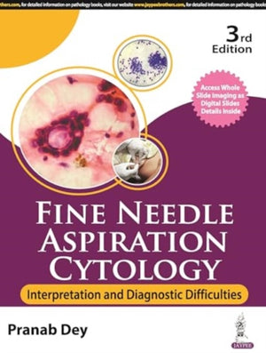 Fine Needle Aspiration Cytology