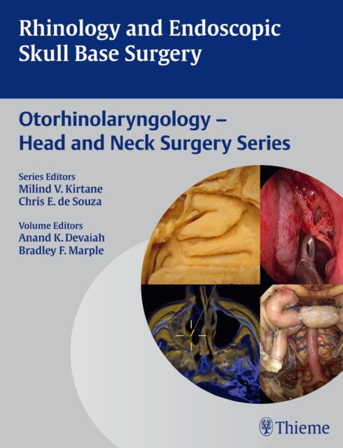 Book cover of: Rhinology and Endoscopic Skull Base Surgery. By: Anand K. Devaiah