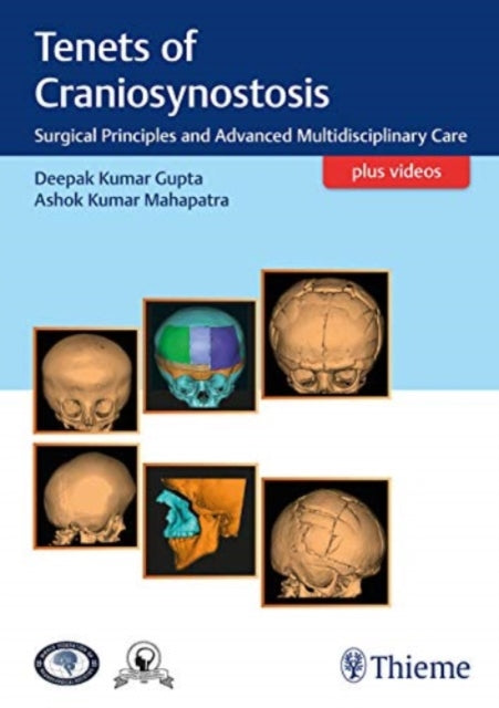 Book cover of: Tenets of Craniosynostosis. By: Deepak Kumar Gupta