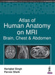 Book cover of: Atlas of Human Anatomy on MRI. By: Parvez Sheik