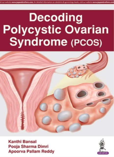 Book cover of: Decoding Polycystic Ovarian Syndrome. By: Kanthi Bansal