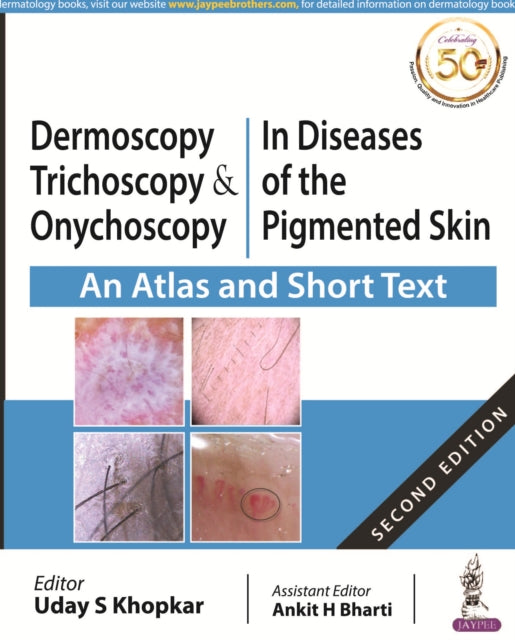 Book cover of: Dermoscopy, Trichoscopy and Onychoscopy in Diseases of the Pigmented Skin. By: Uday Khopkar