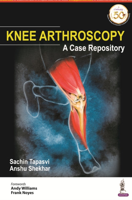 Book cover of: Knee Arthroscopy. By: Sachin Tapasvi