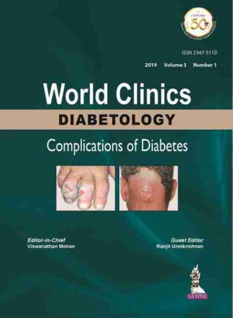 Book cover of: World Clinics Diabetology: Complications of Diabetes. By: Viswanathan Mohan
