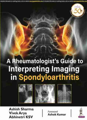 A Rheumatologist's Guide to Interpreting Imaging in Spondyloarthritis