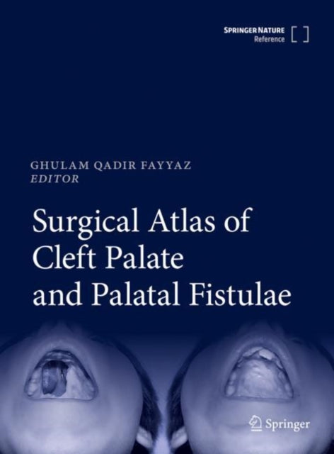Book cover of: Surgical Atlas of Cleft Palate and Palatal Fistulae. By: Ghulam Qadir Fayyaz