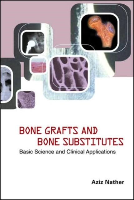 Book cover of: Bone Grafts And Bone Substitutes: Basic Science And Clinical Applications. By: Aziz Nather