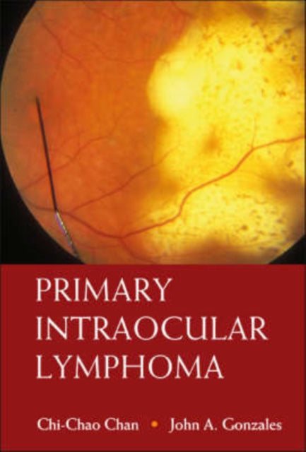 Book cover of: Primary Intraocular Lymphoma. By: Chi-Chao Chan, Chi-chao Chan