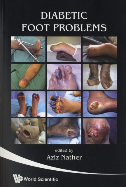 Book cover of: Diabetic Foot Problems