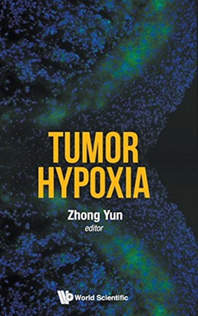 Book cover of: Tumor Hypoxia. By: Yun Zhong