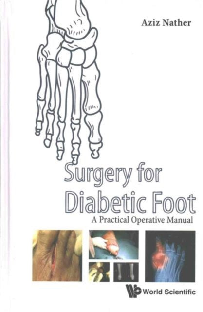Book cover of: Surgery For Diabetic Foot: A Practical Operative Manual. By: Abdul Aziz Nather