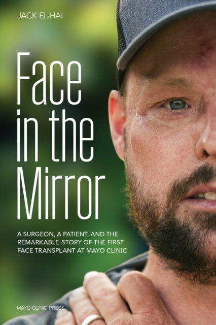 Book cover of: Face Transplant. By: Jack El-Hai